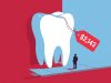 Medicare Has Excluded Routine Dental Care Since 1965. Walter Kowalski’s Advantage Plan Covered $1,300 of His $2,143 Implant. Medicare Has Excluded Routine Dental Care Since 1965. Walter Kowalski's Advantage Plan Covered $1,300 of His $2,143 Implant.